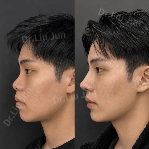 Case 4 - Photo 1